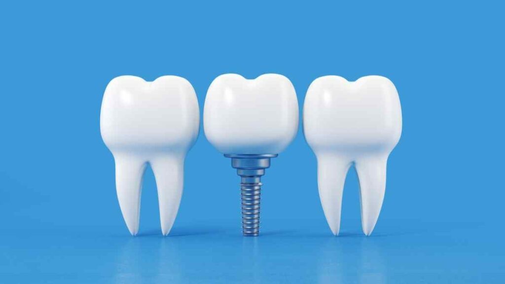 Implante dentário dói